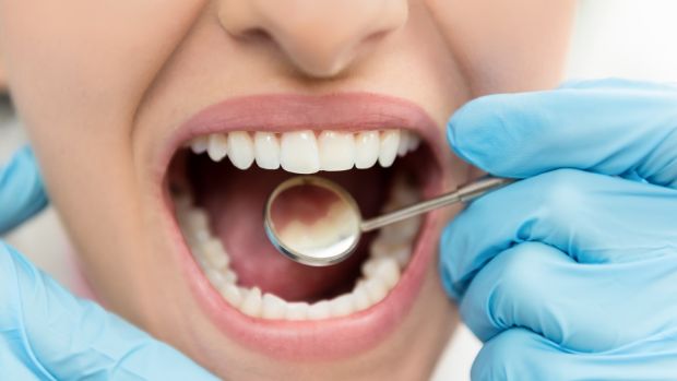 5 Important Strategies For Great Oral Health