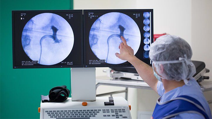 Using Chiropractic Care to Treat Kidney Stones